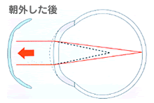 朝外した後